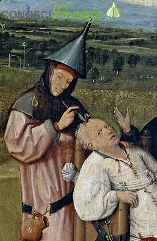 Il quadro di fine Quattrocento di Hieronymus Bosch chiamato Estrazione della pietra della follia mostra una fase dell'intervento nel quale uno stolto si fa convincere da un ciarlatano a farsi togliere dalla testa la pietra della follia.